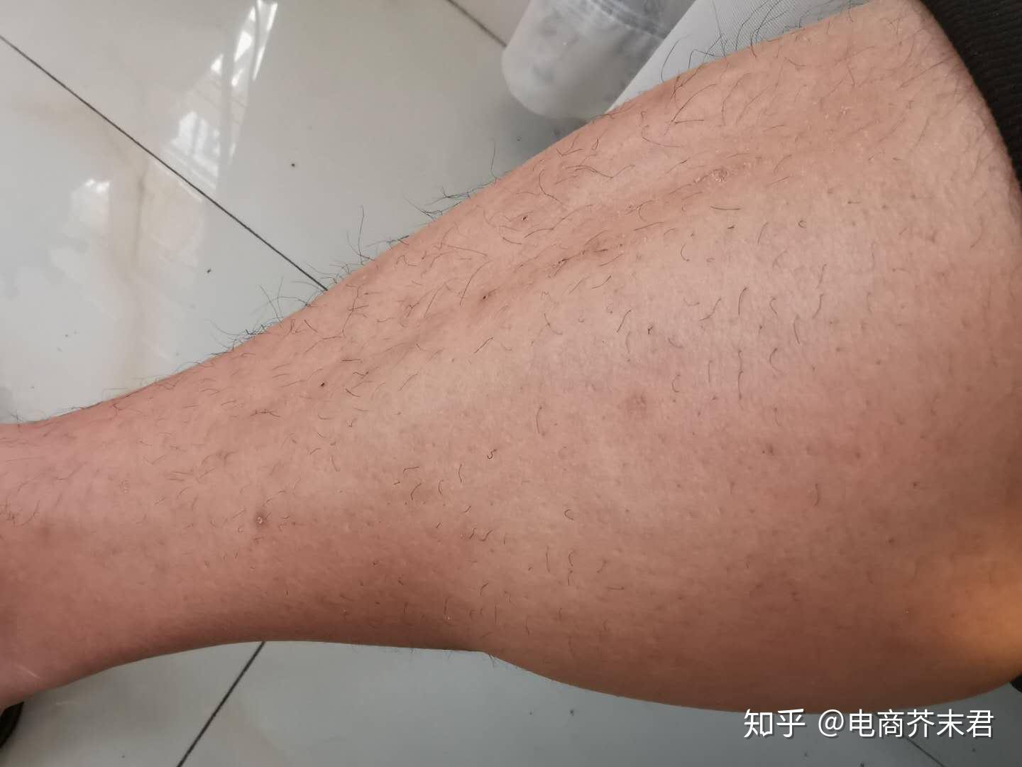 男士脱毛的福音来了女士勿入