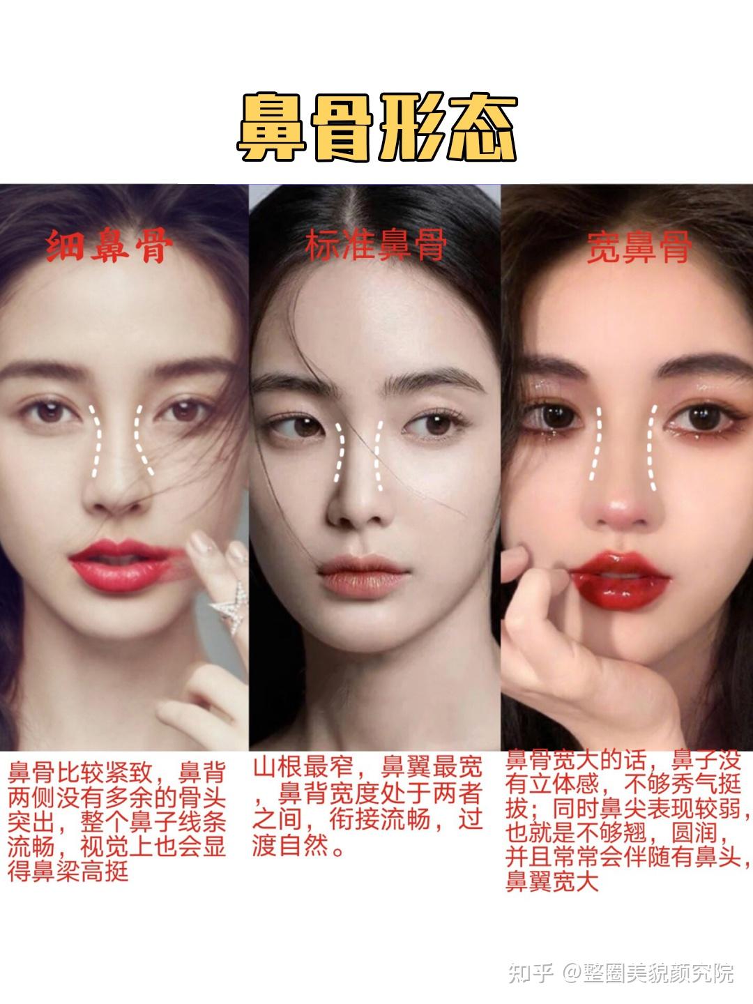 为什么侧面高挺的鼻子,正面却很塌?