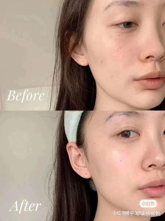 02皮肤弹性松弛