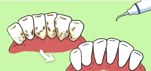 为什么会有口腔肿瘤 v2-61bc93524d174bfc5d083004df18178a_1440w.jpg