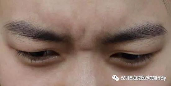 小歌自述:生活中的我总是无意识地皱眉,几乎每一个认识我的人都提醒过