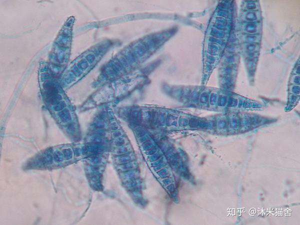 脚气真菌显微镜下照片图片