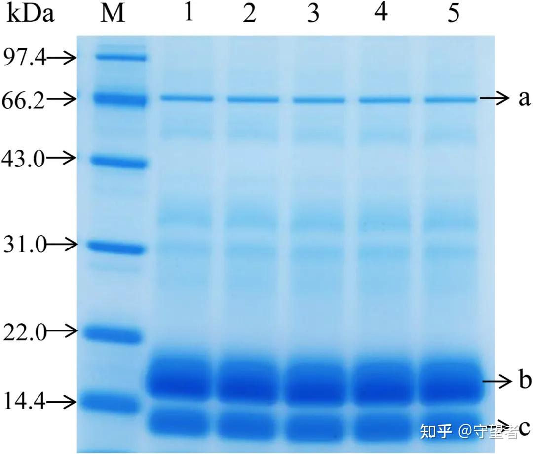 lwt超声改善乳清分离蛋白的功能特性