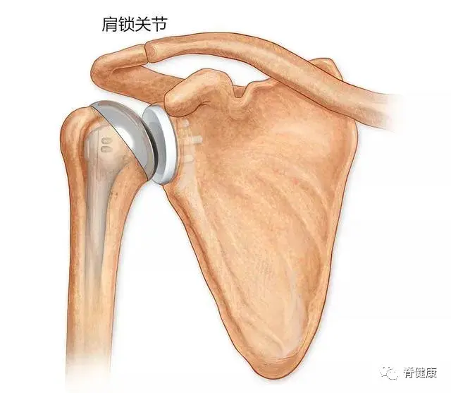 但不是肩胛骨疼痛就一定患有心脏病