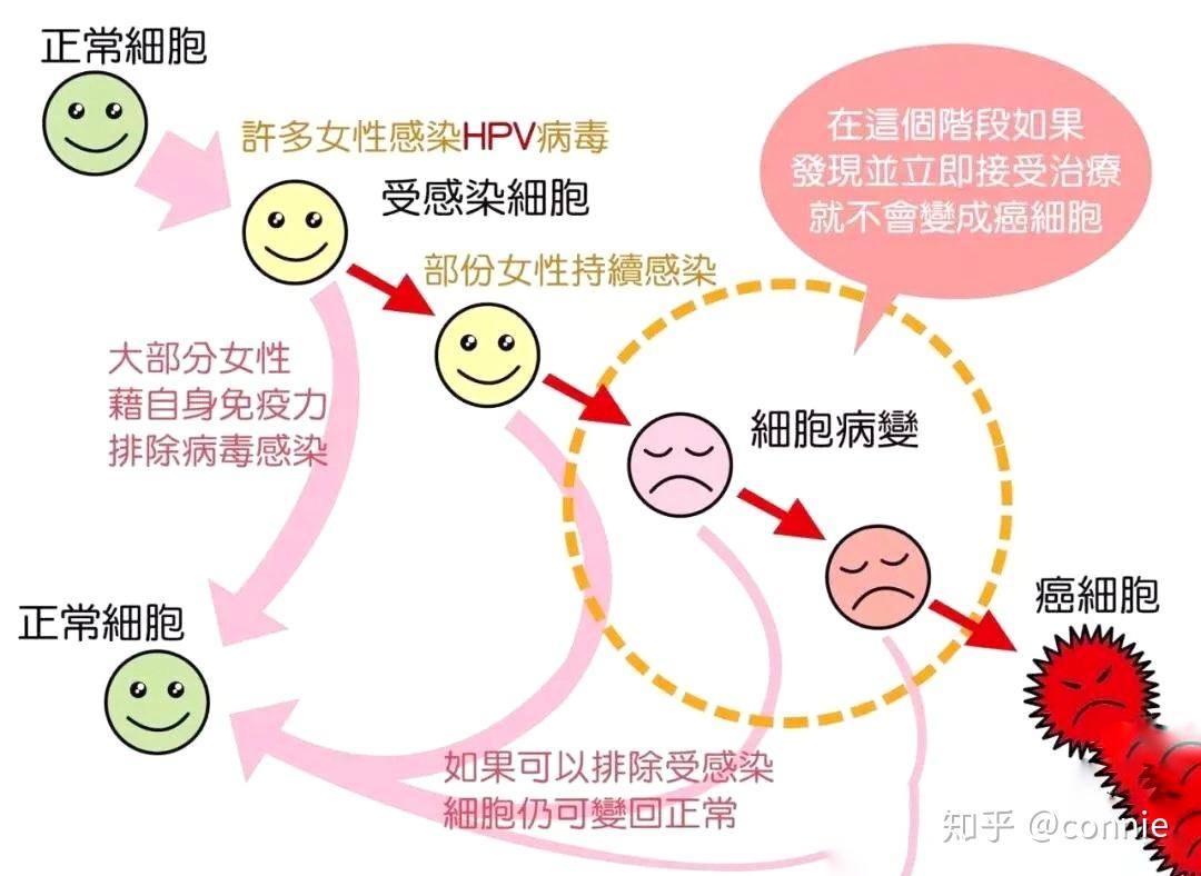 而定期做hpv筛查,则可以早期发现病变,从而针对宫颈病变的不同阶段,有