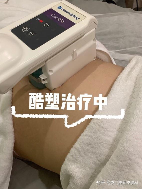 秋冬减脂正当时酷塑冷冻溶脂让你轻松躺出来