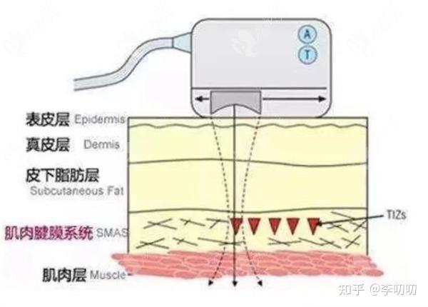 “发腮脸”,你方了吗? - 知乎