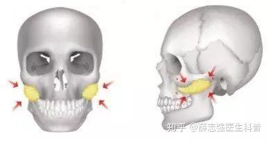 颚骨位置图片,颧骨位置图片,颚骨图片(第2页)_大山谷图库