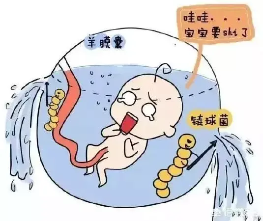 孕妈贴士 羊水检查是孩子的健康卫士 知乎