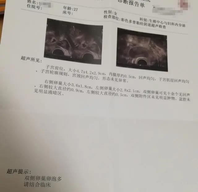 v2-626ac48e80575cde8abd6baaafdddce6_1440w.jpg?source=172ae18b