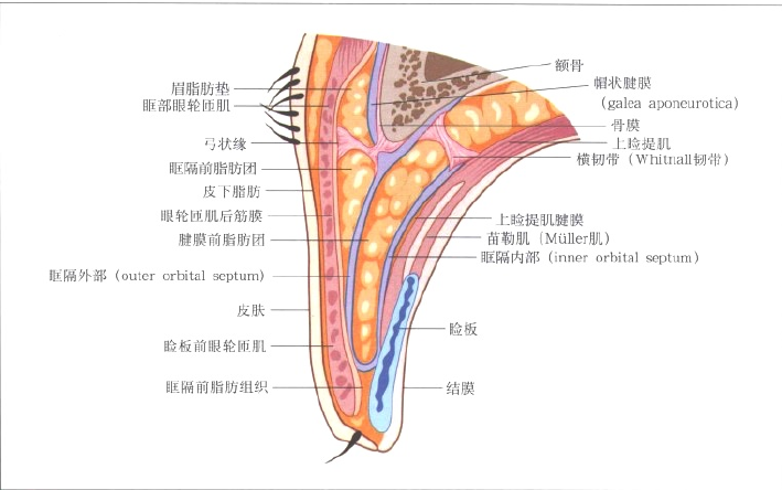 眶隔脂肪在哪里图片