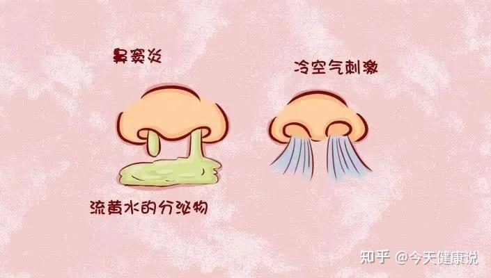 鼻子堵塞快速解决方法图片