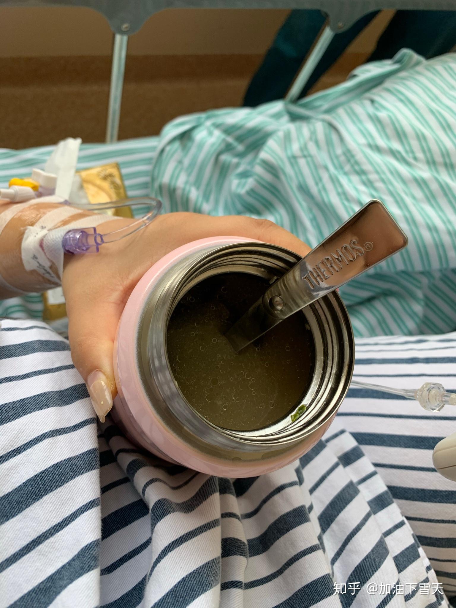 术后消肿阶段术后恢复期间～每天就是挂盐水～止痛针～消肿药