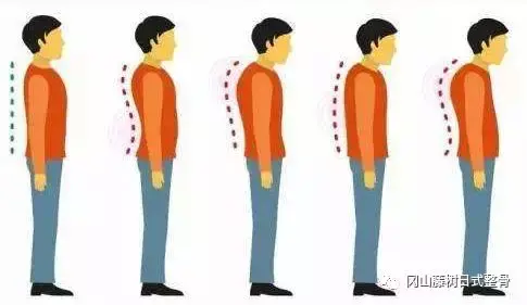 金手指之 猫背 篇 知乎