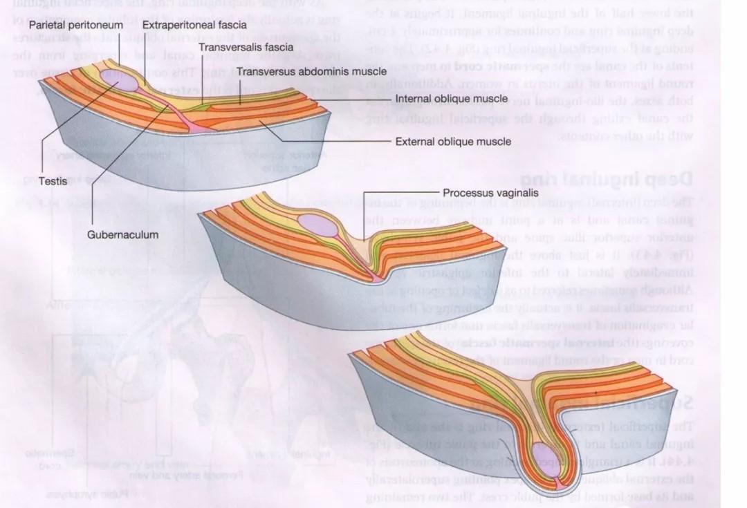 带和睾丸鞘膜髂窝(3个月)—腹股沟管腹环(7个月)—腹股沟管皮下环(7-9