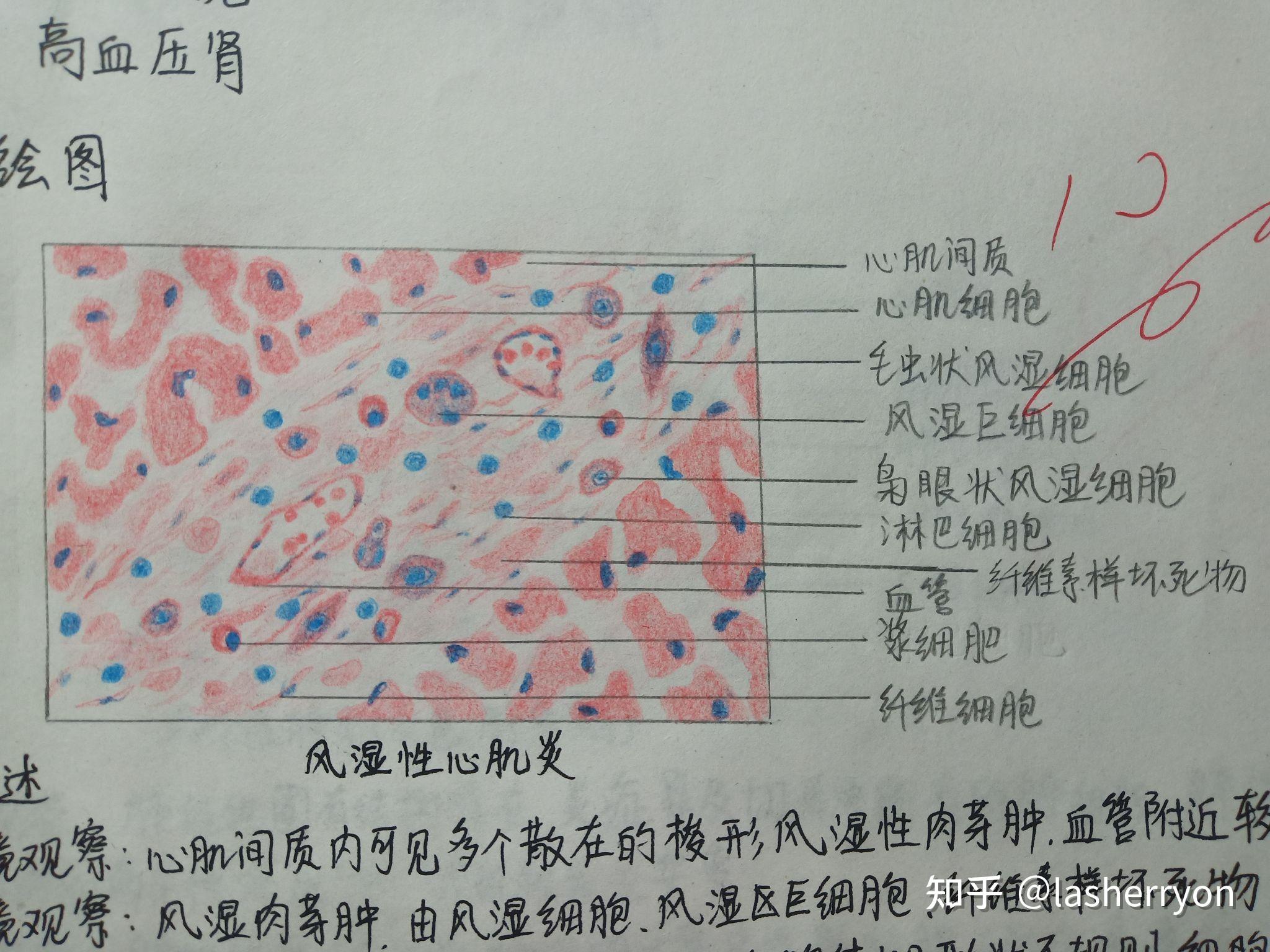 肌纤维红蓝铅笔图图片