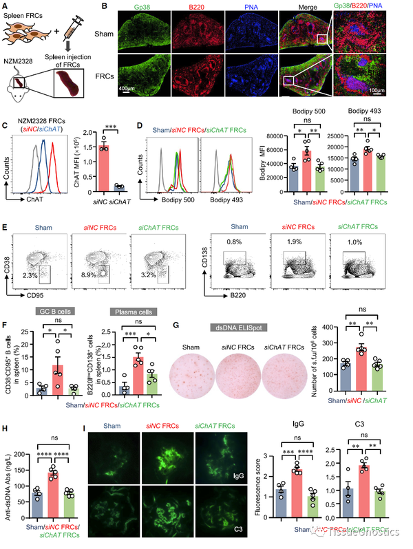 Cell Metabolism|中大附一张辉教授、杨念生教授团队发现脾成纤维网状细胞可促脂质代谢驱动自身反应性B细胞响应 - 知乎