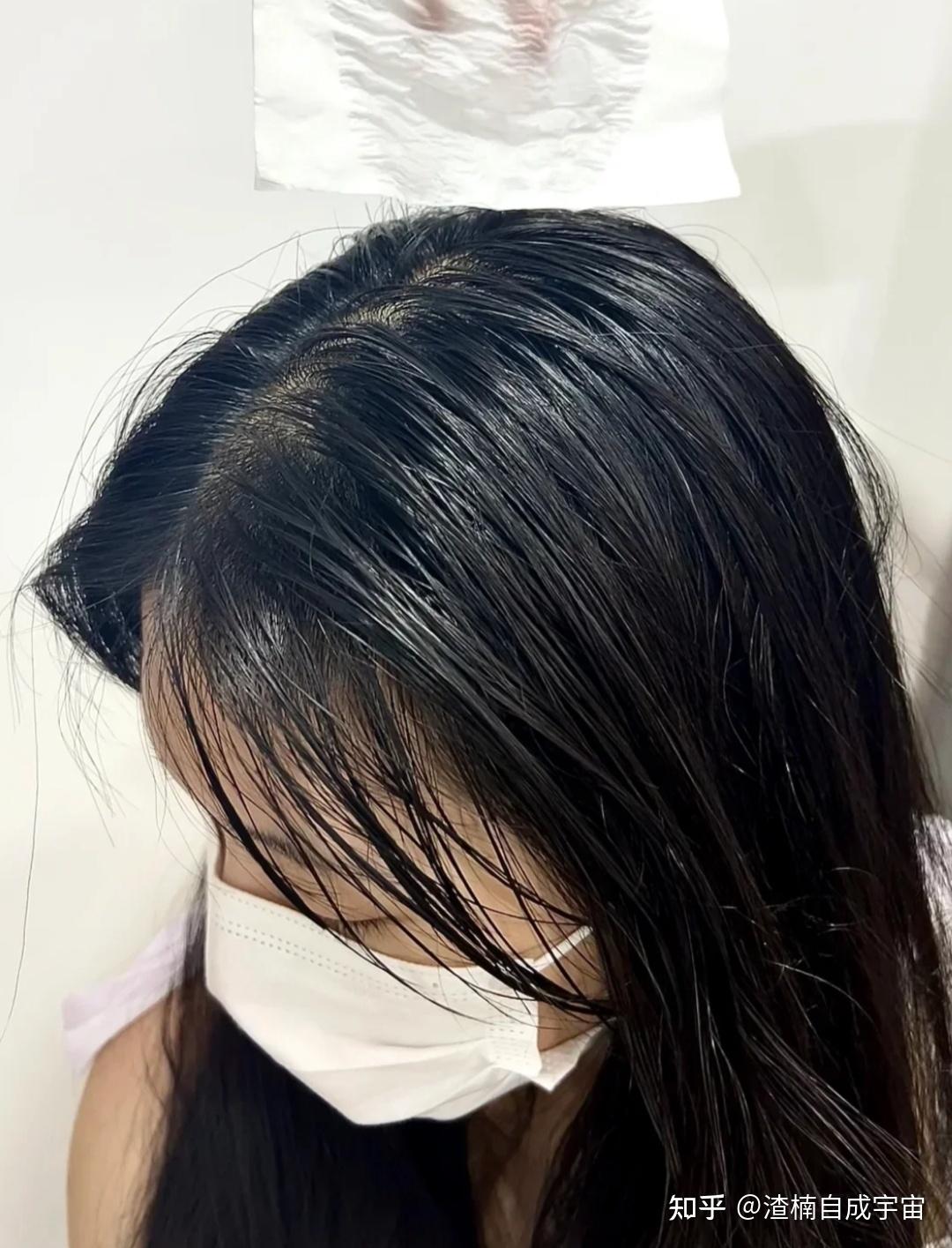 头发油的能炒菜该怎么办?