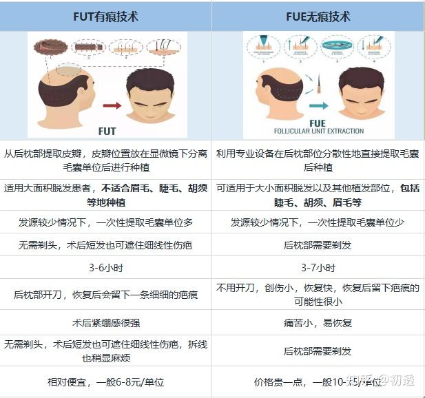 惠州哪家医院植发比较好(惠州哪家医院植发比较好点)