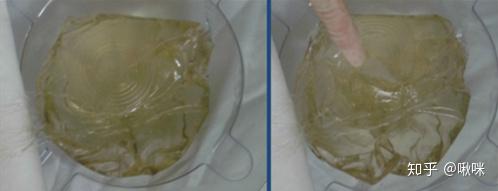 由于人体的排异作用,会在假体周围形成膜,把假体包住,包膜挛缩分为4级