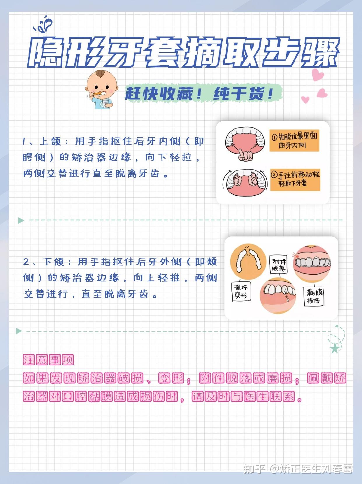 干货篇||隐形牙套注意事项,拿走不谢!