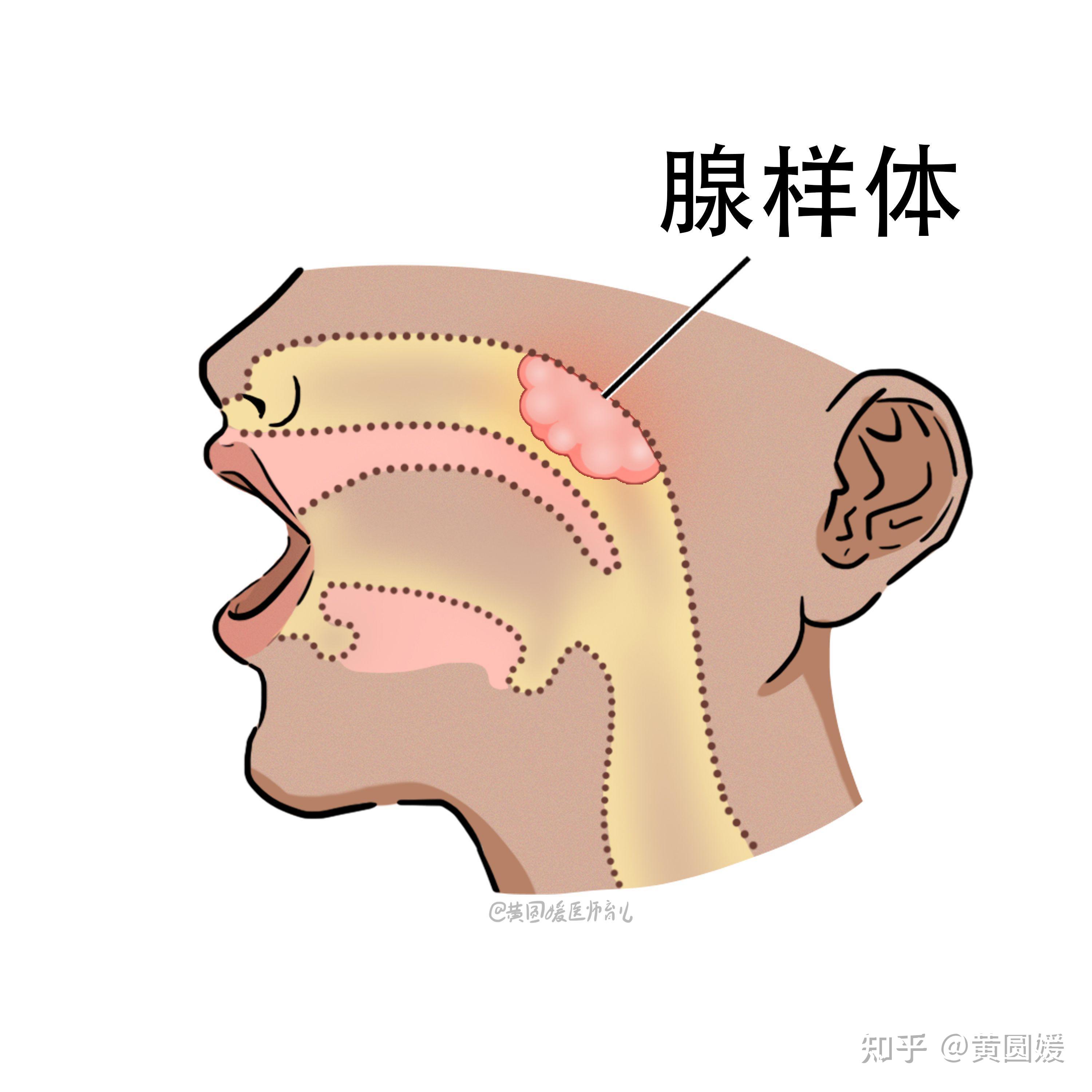 出疹子尿频口干舌燥是生病还是排毒