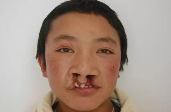 唇腭裂婴儿回归正常人生活的韩佩泉,把握住了时尚的浪潮,凭借自己过人