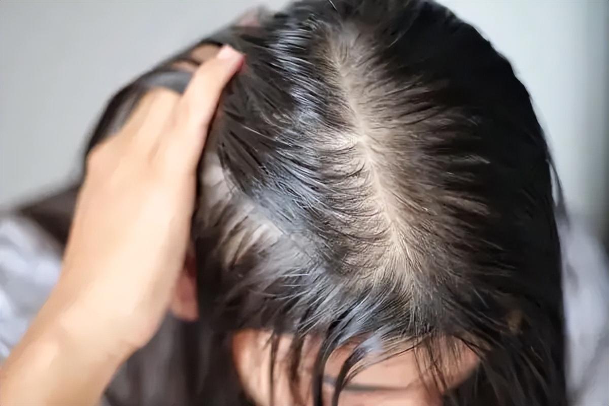 用4种方法解决油性头发问题!