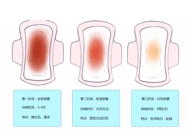 产后修复必做的三大项目之子宫复旧 - 知乎