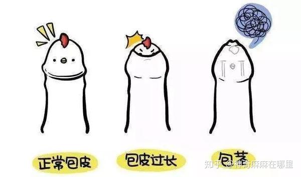 一分钟育儿小鸡鸡包皮是不是非割不可