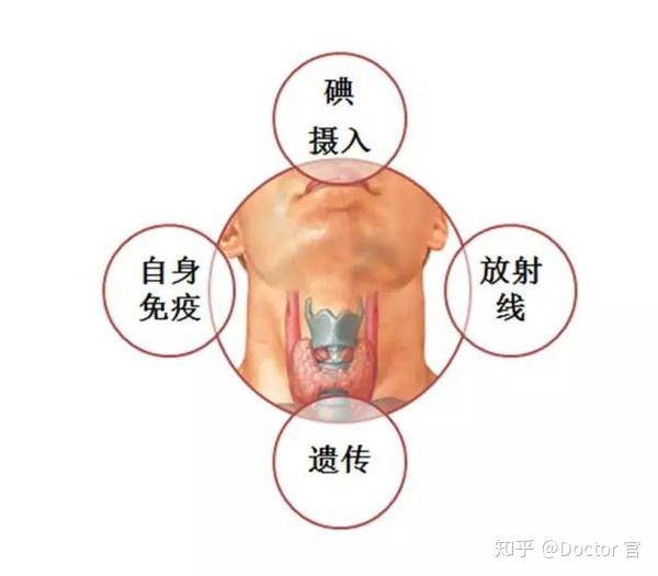 刀下留情这种甲状腺结节根本不用切连治都不用治