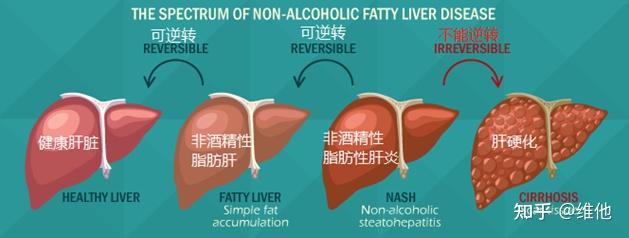 脂肪肝是肝硬化疾病的發病機制的第一步,下圖簡化了肝硬化的發病機制
