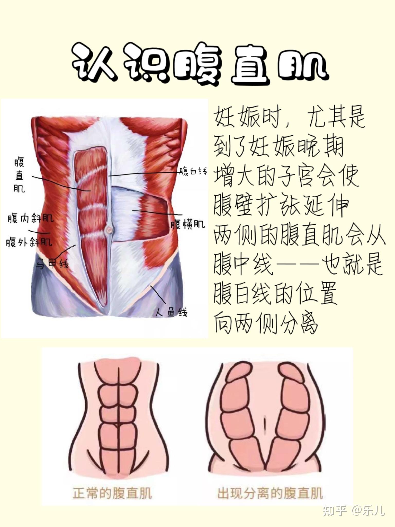 腹直肌分离2指图片