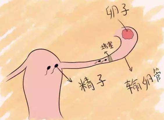 女性的输卵管不通畅会有什么症状呢?插图 女性的输卵管不通畅会有什么症状呢?