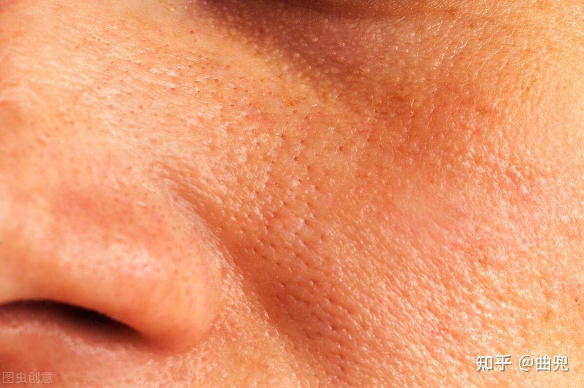 油性皮肤产生的原因 油性皮肤如何护理-百度经验