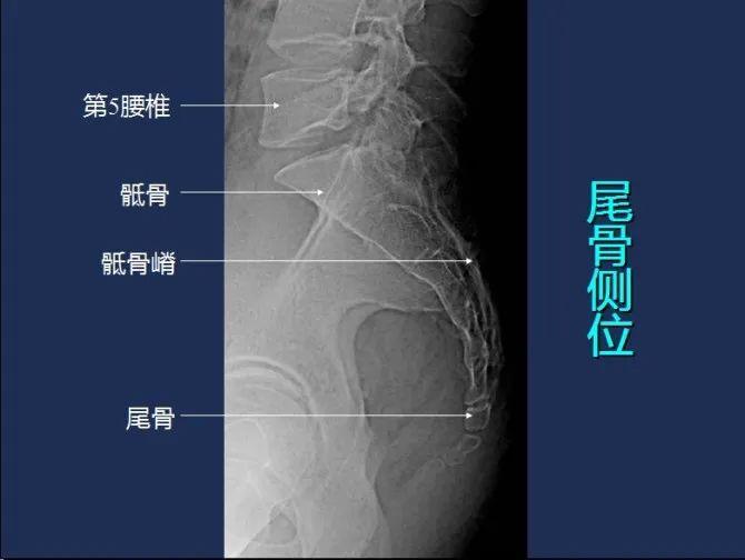 部位叫什么,不得已翻书,刚好今天为大家整理汇总了常用x线影像解剖图