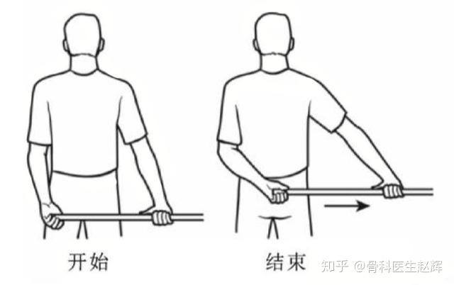 肩周炎肩膀痛赵辉医生教您如何正确锻炼