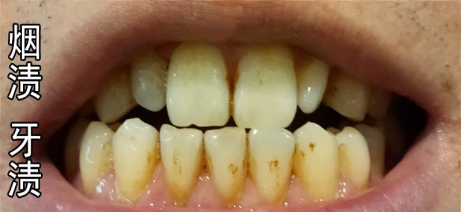 2024年美白牙膏段位榜男士美白牙膏真实测评让你远离牙