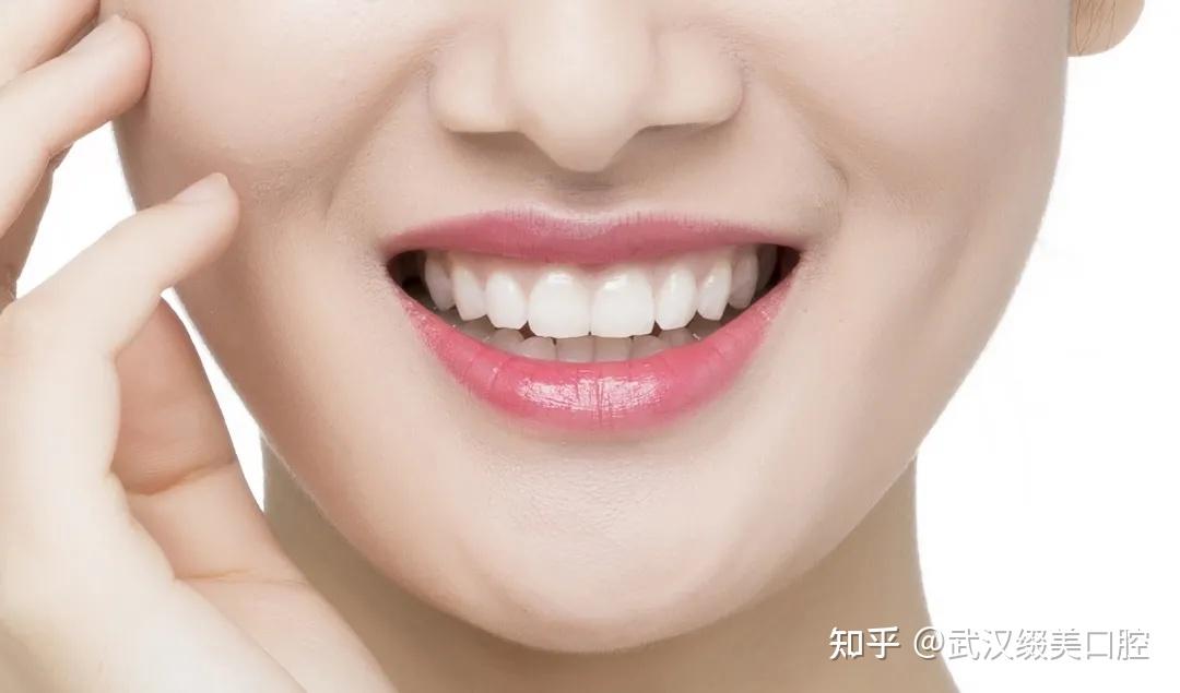 一口整洁的牙齿总能给人加分武汉缀美口腔 缔造最美微笑武汉缀美口腔