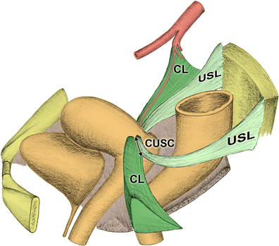 suspensory ligament of ovary 卵巢懸韌帶 = infundibulopelvic