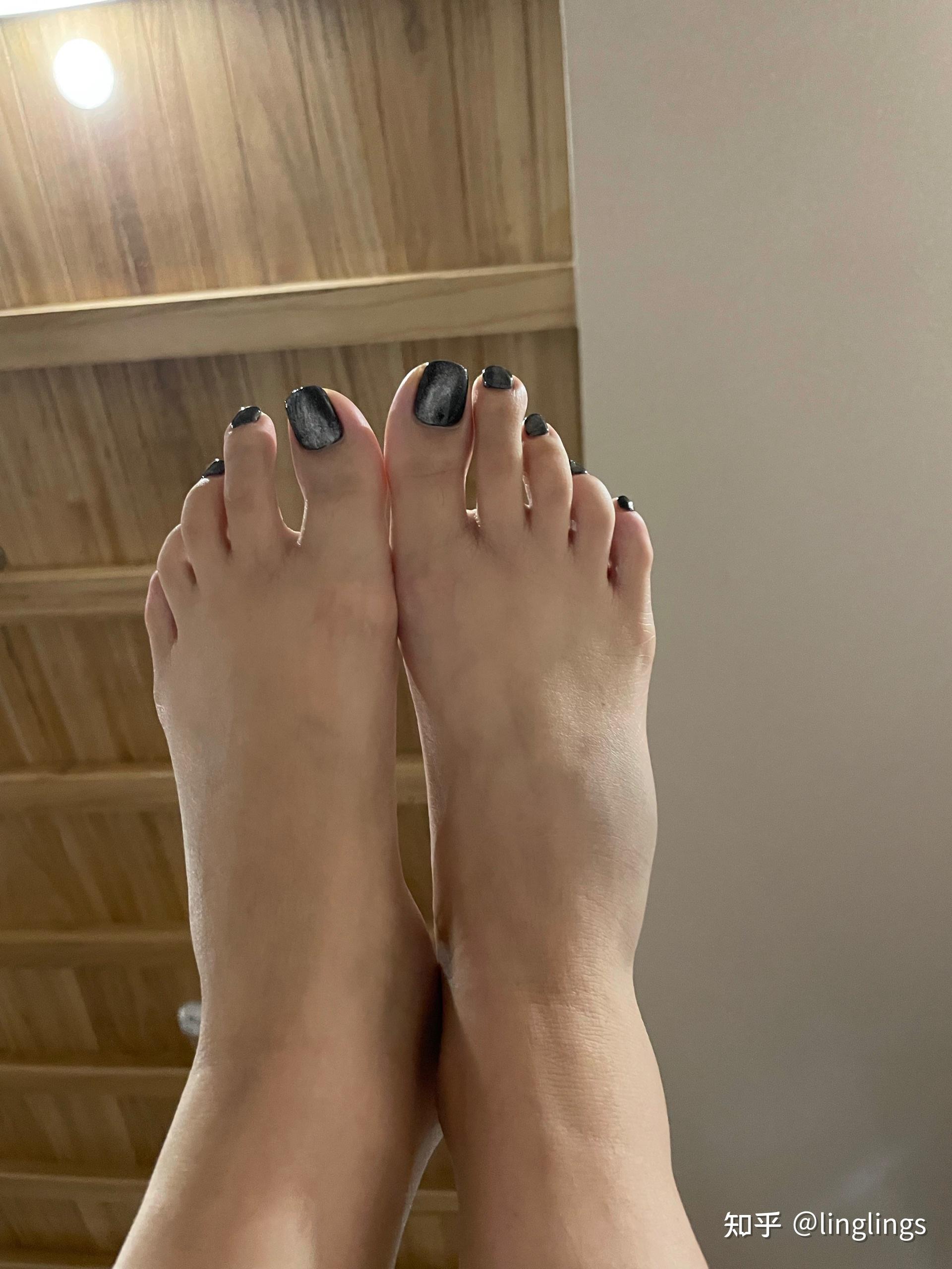 出去玩脚崴了 - 知乎