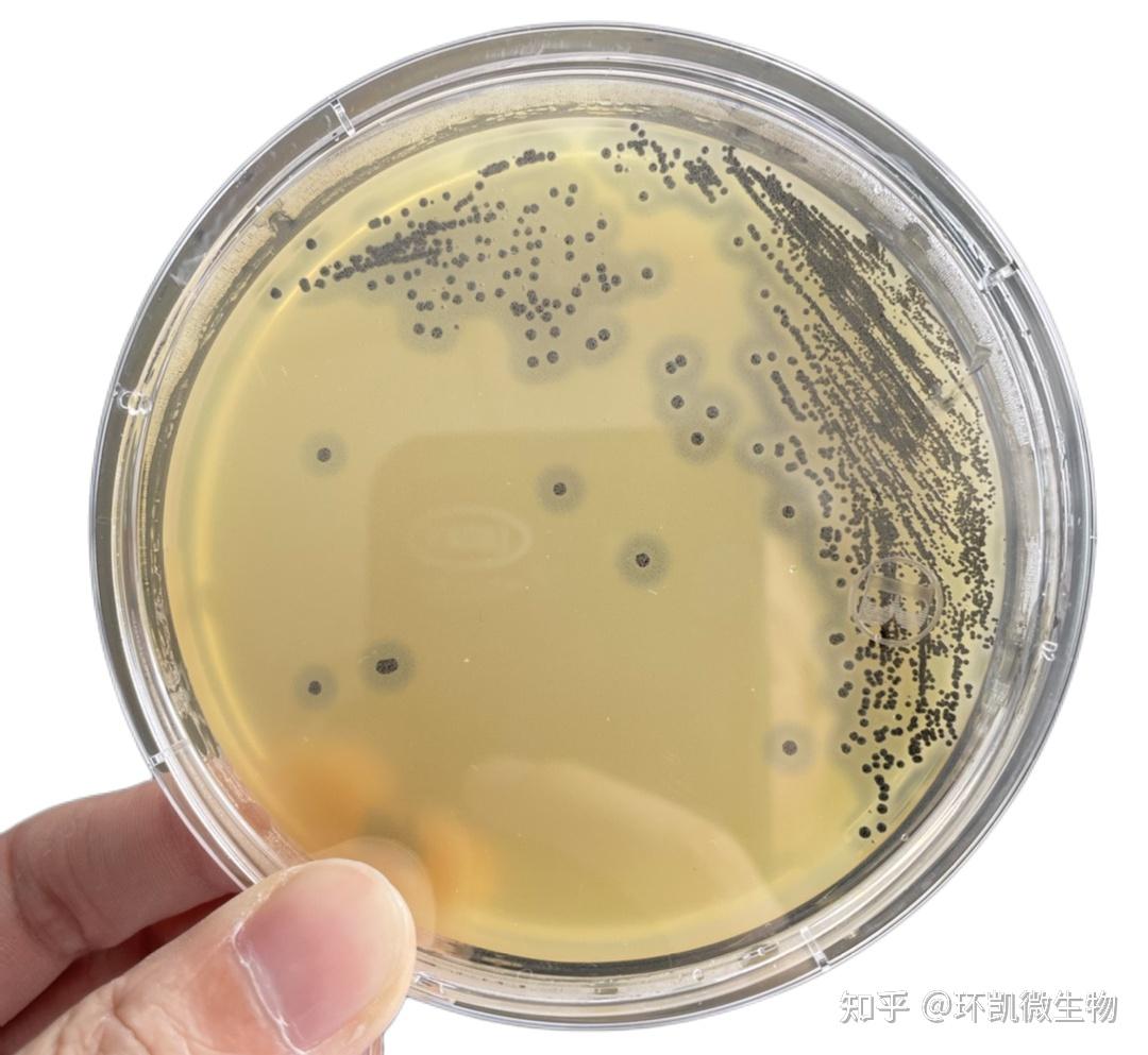 啤酒检测中常见的微生物菌落形态 - 知乎