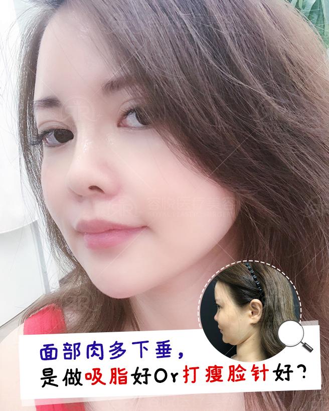 v2-65ba215f44280ef3403b84531e5b7ef9_1440w.jpg?source=172ae18b