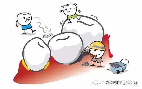 洗牙后注意事项 知乎