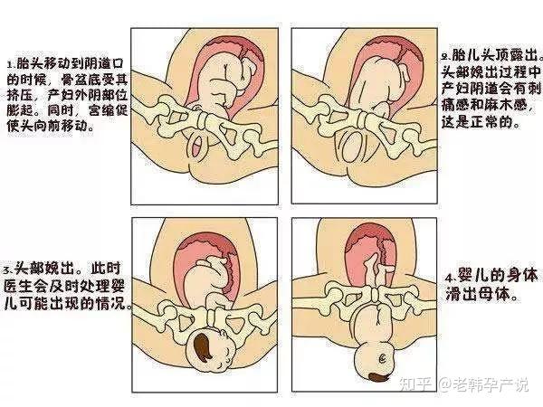 顺产生孩子是种怎样的体验