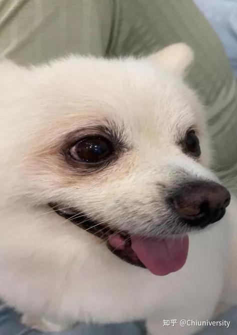 21 治疗 20 多天后眼睛外观情况(睑板腺囊肿消失)本期案例来自谭友华