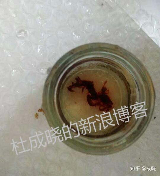 4 天前 宫腔粘连患者吃中药治疗一段时间后,可以排出一些