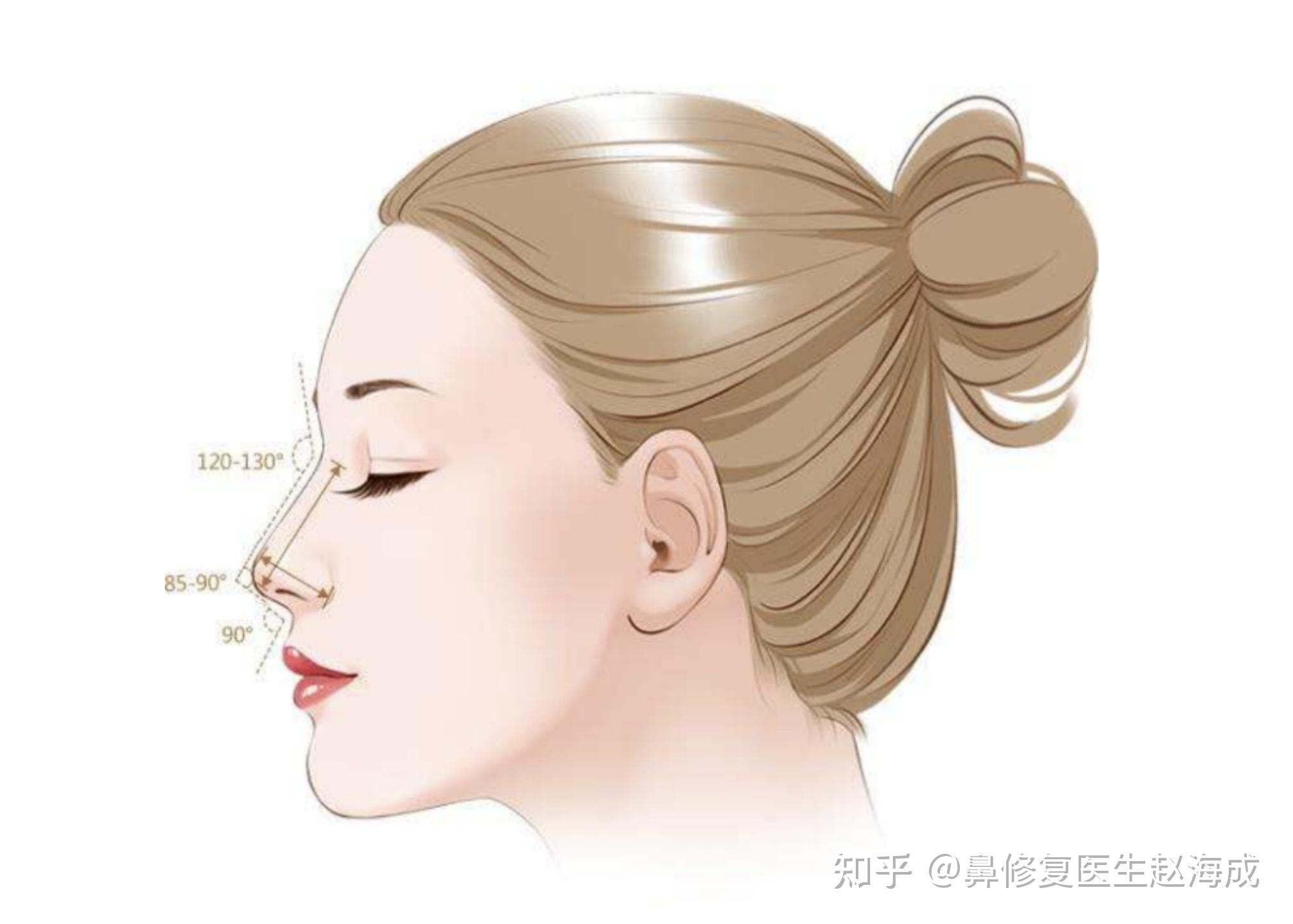 鼻整形的美学标准、常见手术项目、方法及术后护理 - 知乎