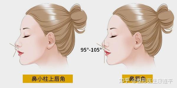 鼻子审美(三)-鼻唇角美学 - 知乎
