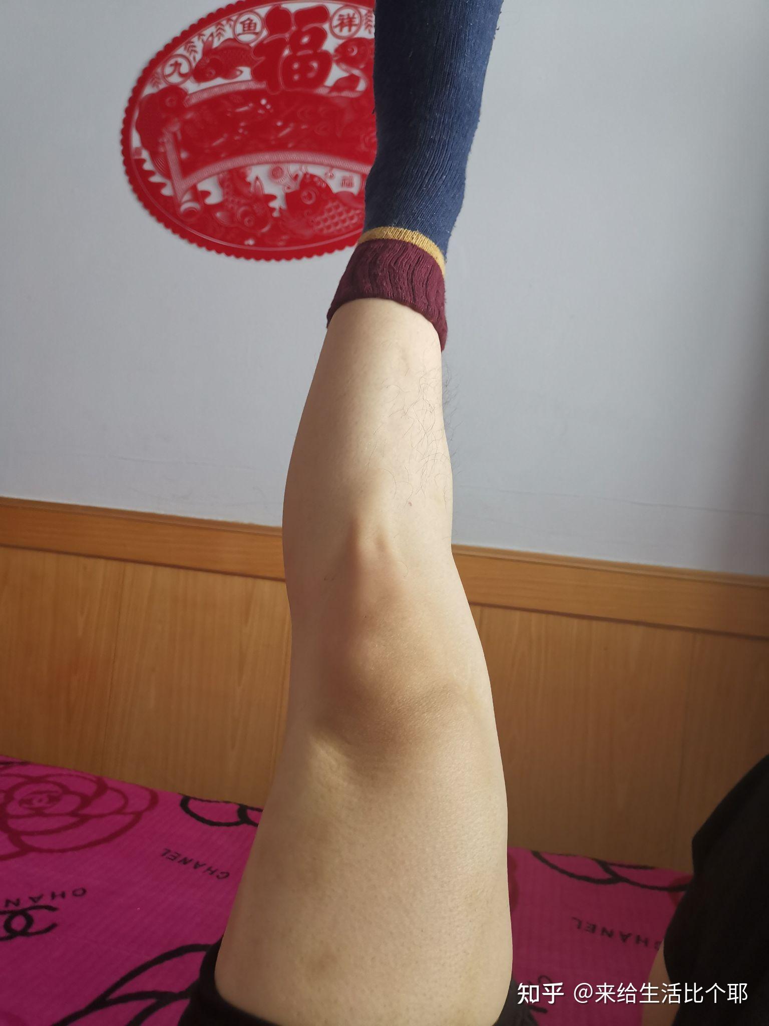 这种腿型还有救么大腿没问题脚没啥问题小腿有封